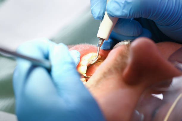 Best Same-Day Emergency Dentist in Sidney, IL